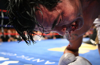 Артуро Гатти, бокс