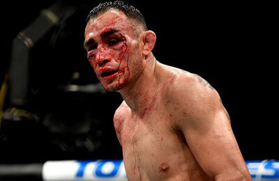 UFC, MMA, Тони Фергюсон