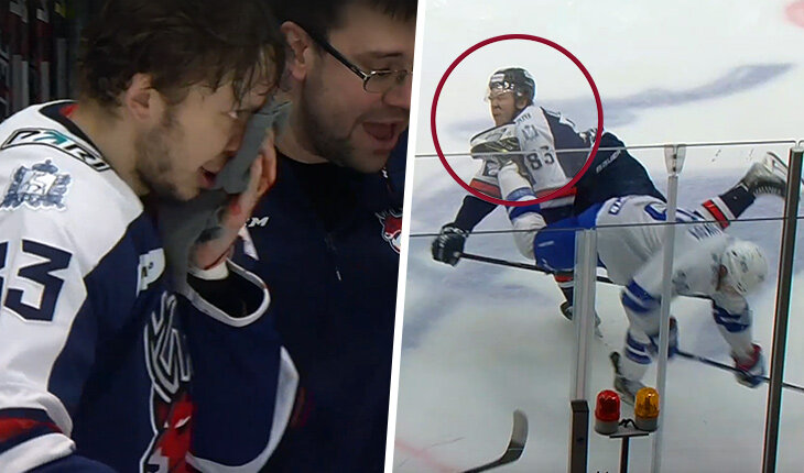 Кошмар: игроку «Торпедо» порезали лицо коньком. Это был его первый матч в плей-офф-2023