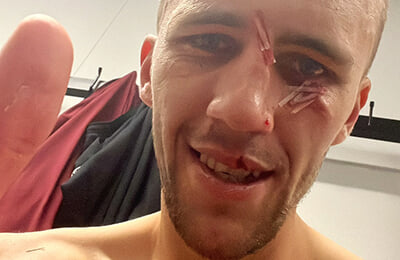 Эвертон, Хосе Саломон Рондон, Томаш Соучек, Вест Хэм, премьер-лига Англия