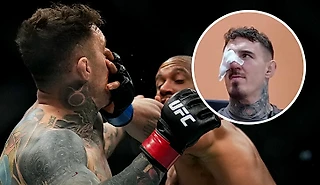 «Драться с одним глазом – обычное дело». Чемпиона UFC захейтили за снятие с титульника