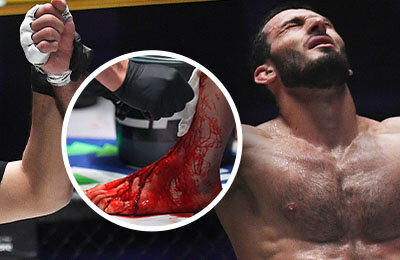 MMA, ACA, Альберт Туменов, Артем Резников, Али Багов, Биберт Туменов, Магомедрасул Гасанов, Эдуард Вартанян, Александр Шлеменко