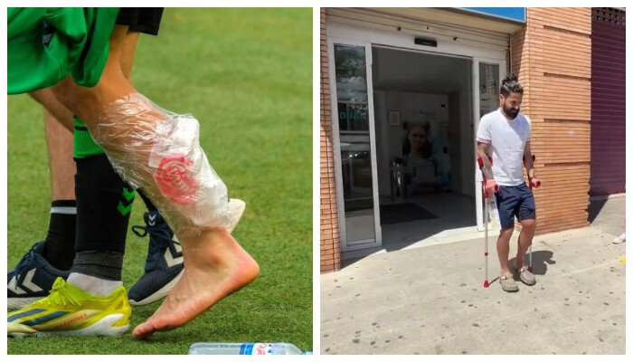 Иско получил тяжелую травму и пропустит Евро🚨