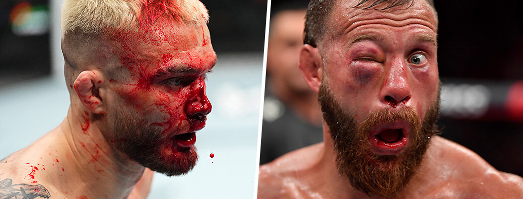 Красота и ужас UFC – в 48 кадрах главного фотографа