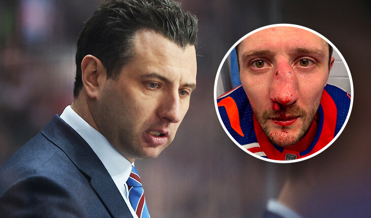 Фотография поста в ленте «У нас лужи крови в раздевалке». Таким Ротенберг увидел матч СКА и «Локомотива»