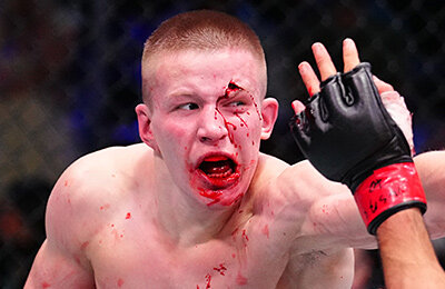 Парню из Карелии раскрошили все лицо – и дали контракт в UFC