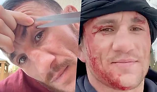 Мераб – главный псих UFC: подтягивается на утесе, танцует у обрыва, снимает швы садовыми ножницами