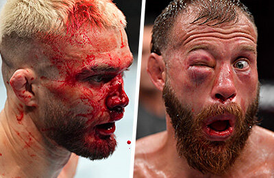Красота и ужас UFC – в 48 кадрах главного фотографа