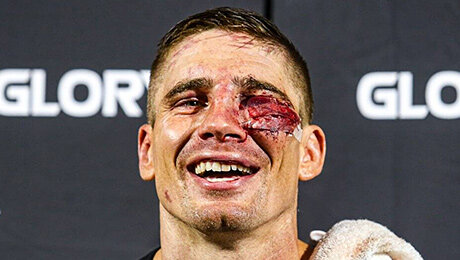 Получил рыцарский статус, дружит со Стетхемом, дерется с шести лет. Это новый соперник Усика