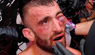 6 нокдаунов за 2 раунда и страшная гематома – жесть на UFC в Абу-Даби