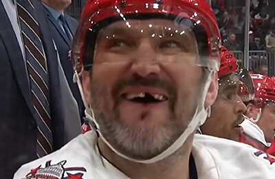 Овечкину выбили еще один зуб! Просто посмотрите на эту улыбку