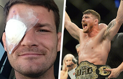 Ослепнуть на один глаз, но все равно стать чемпионом UFC. История Майкла Биспинга