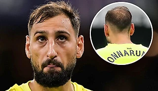 Доннарумма в 26 стремительно теряет шевелюру. Почему так рано?