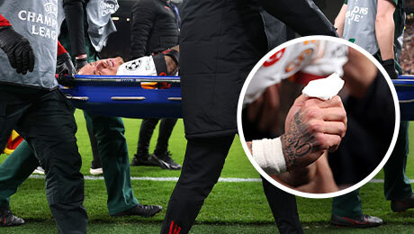 Лангу из «Галатасарая» отрезало часть пальца. Кошмар из-за рекламного щита на «Энфилде»