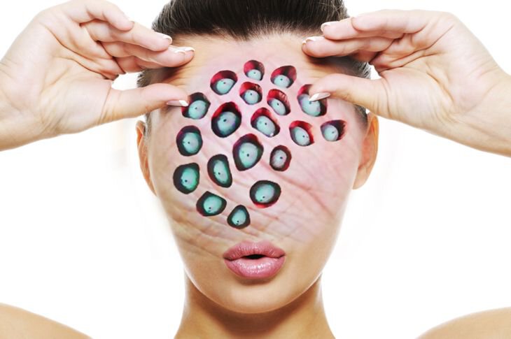 Восстановление, психология