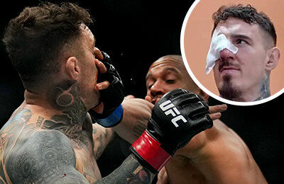 «Драться с одним глазом – обычное дело». Чемпиона UFC захейтили за снятие с титульника