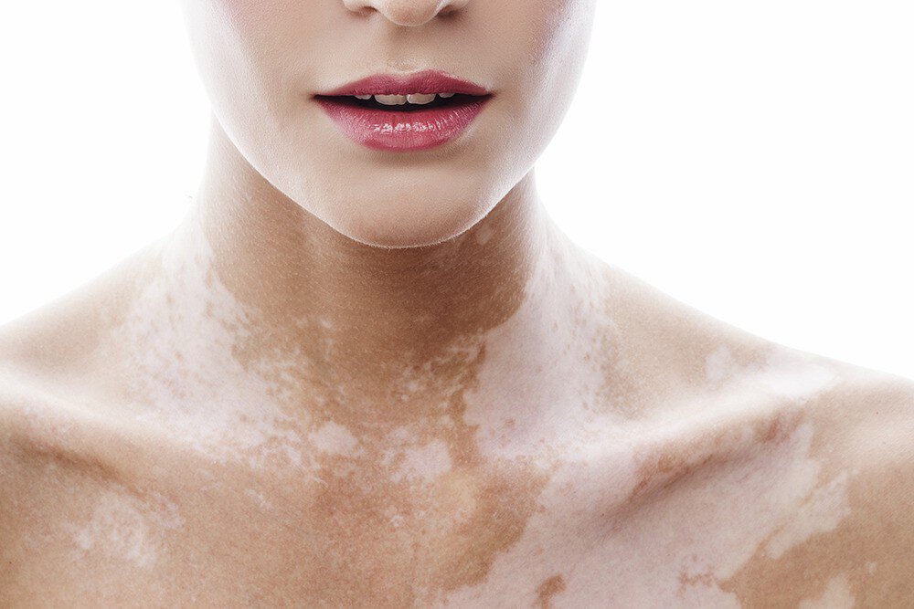 Здоровье, #безбилета