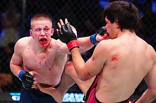 Парню из Карелии раскрошили все лицо – и дали контракт в UFC