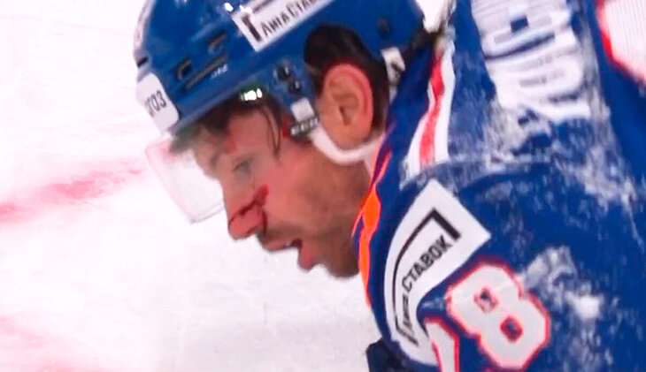 Фотография поста в ленте СКА теряет игроков: капитан не играет из-за сотрясения, Толчинский – в крови после «Динамо»