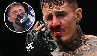 Тычок в глаз, который сорвал титульник UFC. Грязь?