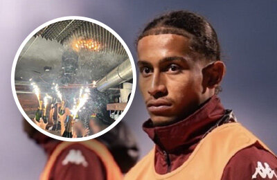 Игрок «Меца» спас девушку из страшного пожара. У него серьезные ожоги и тяжелое состояние