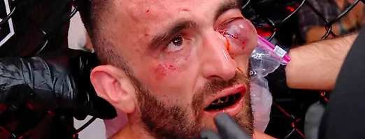 6 нокдаунов за 2 раунда и страшная гематома – жесть на UFC в Абу-Даби