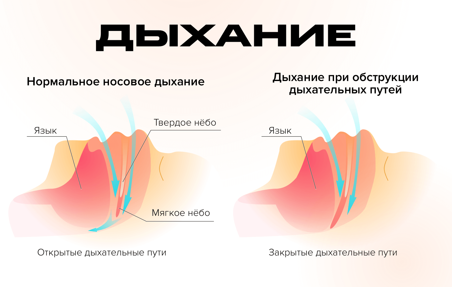 stanokmolotok.ru - Laste hammaste tervis - Ротовое дыхание