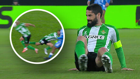 Ну как обидно и глупо: Иско травмировал партнер ударом в ногу. Он же только вылечился!