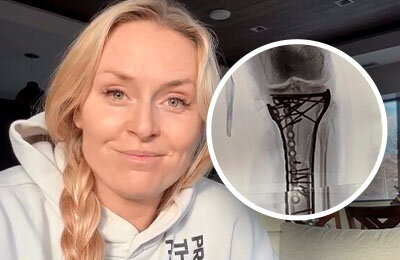 Линдси Вонн, травмы, горные лыжи, Олимпиада-2026, сборная США жен