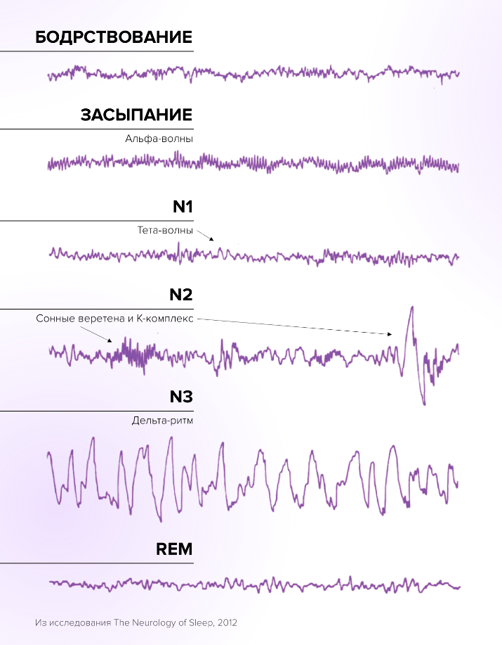 Rem фаза сна. Сонные веретена на ЭЭГ. В какую фазу сна лучше просыпаться. ФМРТ мозга фазы сна Rem.