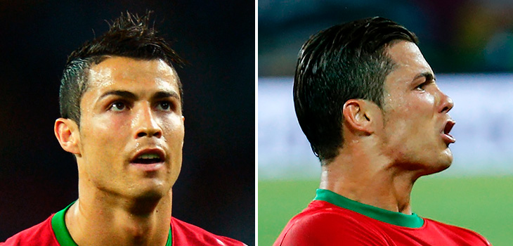 Криштиану Роналду — фотографии португальского футболиста после пластической коррекции лица