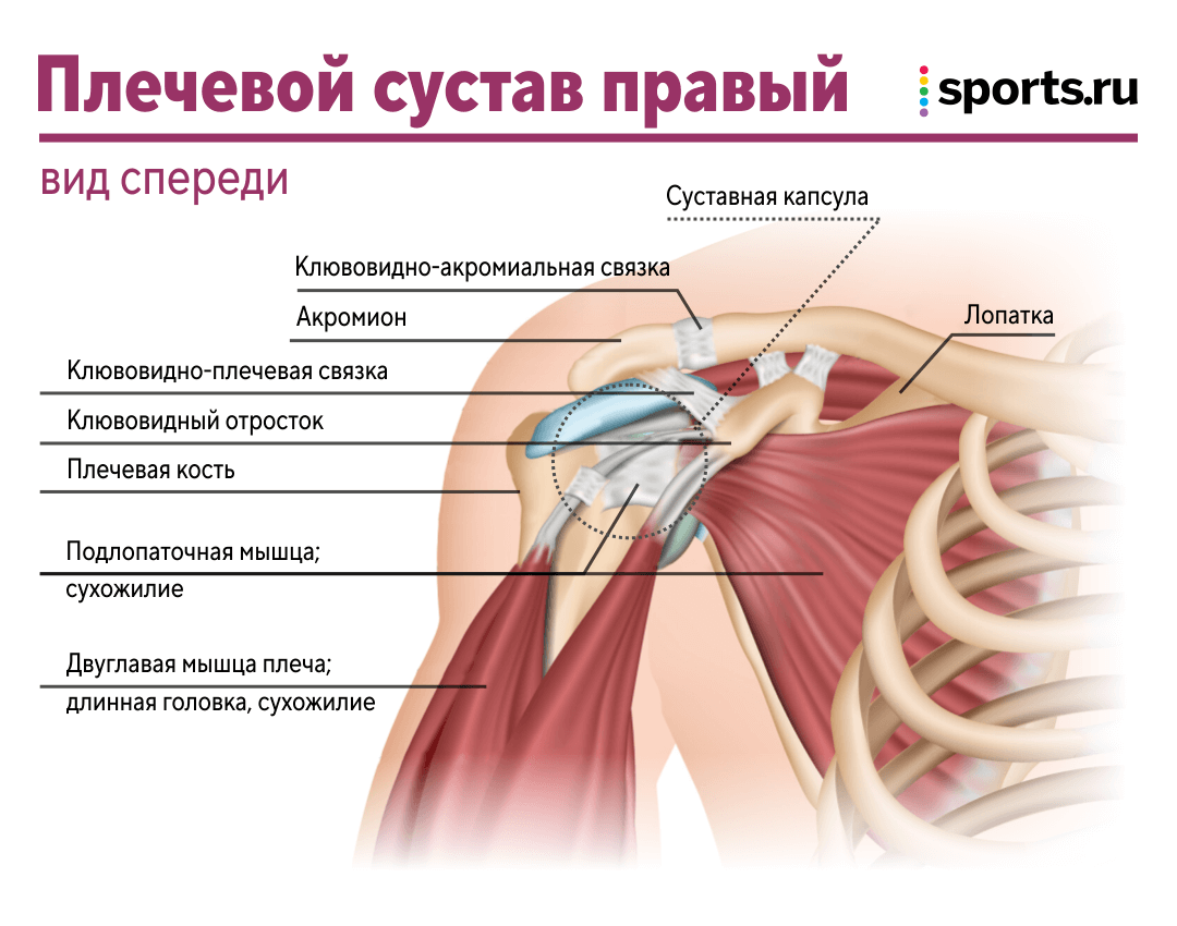 Воспаление сухожилий плечевого сустава (Тенденит)