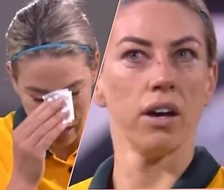 В сети завирусилось видео реакции футболистки на свой сломанный нос