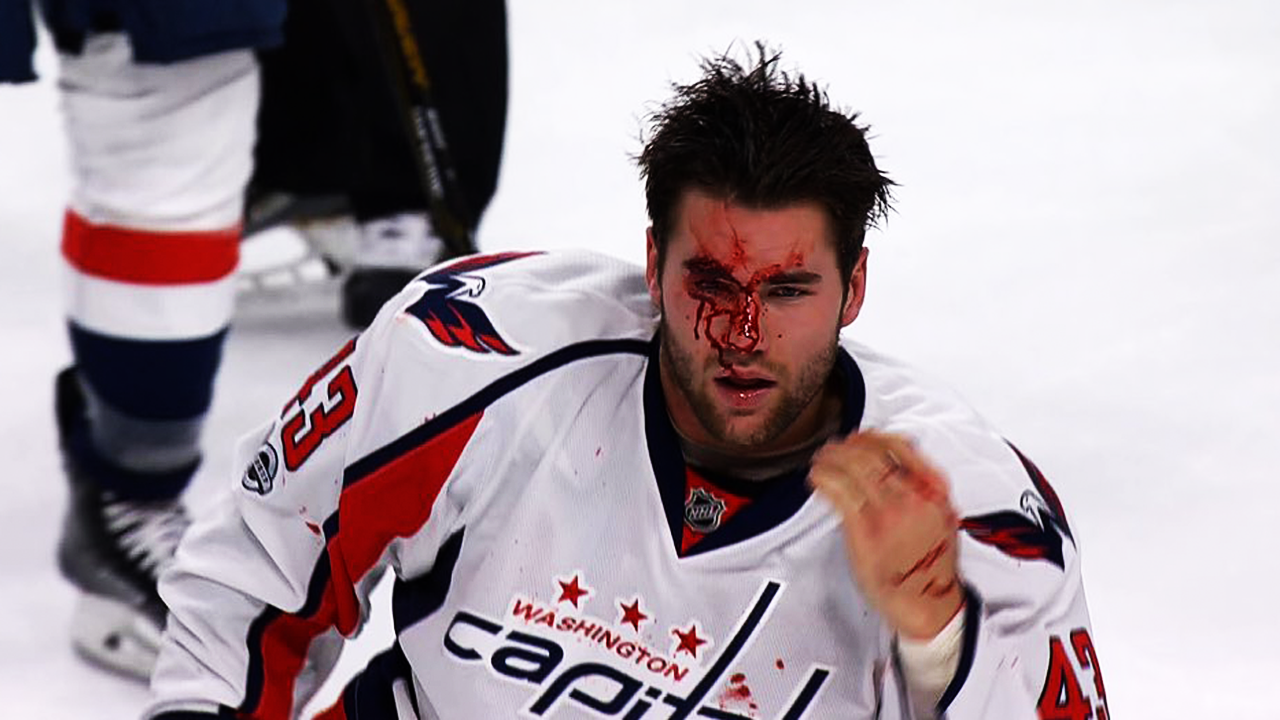 ЗРЕЛИЩНЫЕ ДРАКИ В ХОККЕЕ - ОВЕЧКИН ПАНАРИН КОВАЛЬЧУК