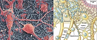 Свинки, обезьянка и Neurolink Илона Маска