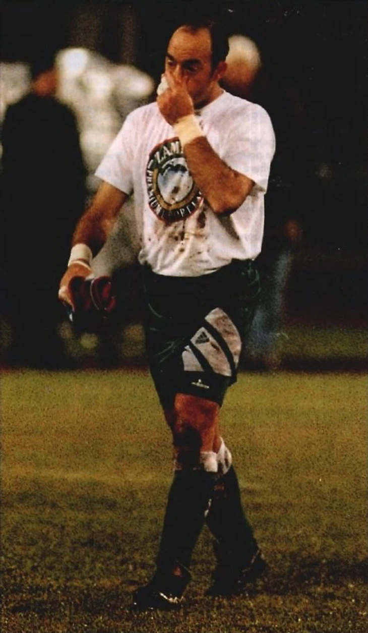 Удаление в Москве