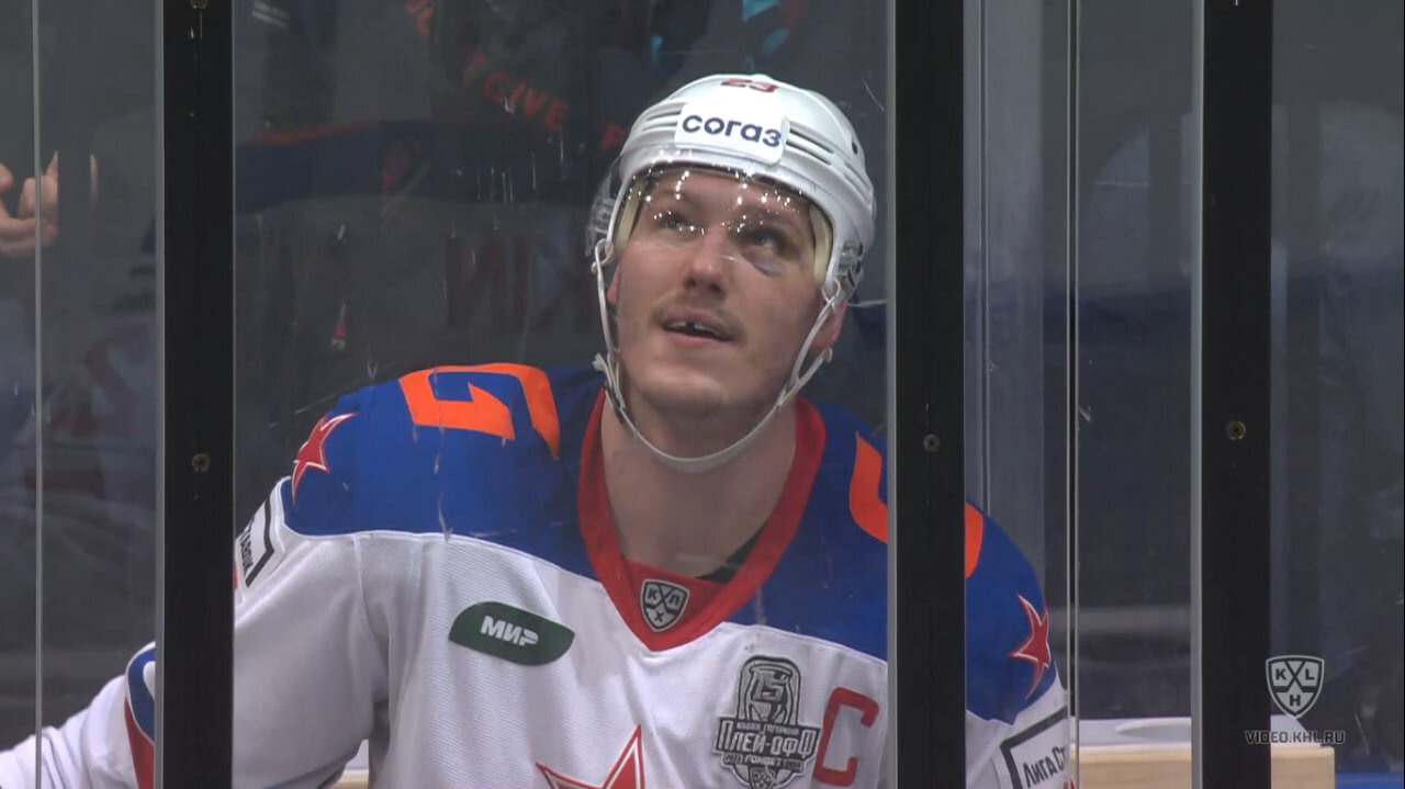 Огромный фингал, выбитый зуб – капитан СКА наводит ужас на соперников одним видом