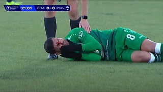 Полузащитник «Рубина» Йевтич получил удар локтем и потерял сознание в матче Кубка России