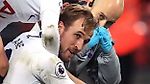 Harry Kane: Tottenham boss Mauricio Pochettino says ankle injury would be 'massive'