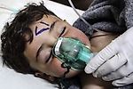 Шведские врачи бьют тревогу: сирийских детей убивали в кадре для фейка о газовой атаке