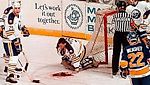 "Не хотел умереть на льду на глазах тысяч людей". Самая жуткая травма в истории НХЛ