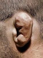 борчик, борчик