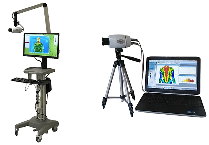 Медицинские тепловизоры