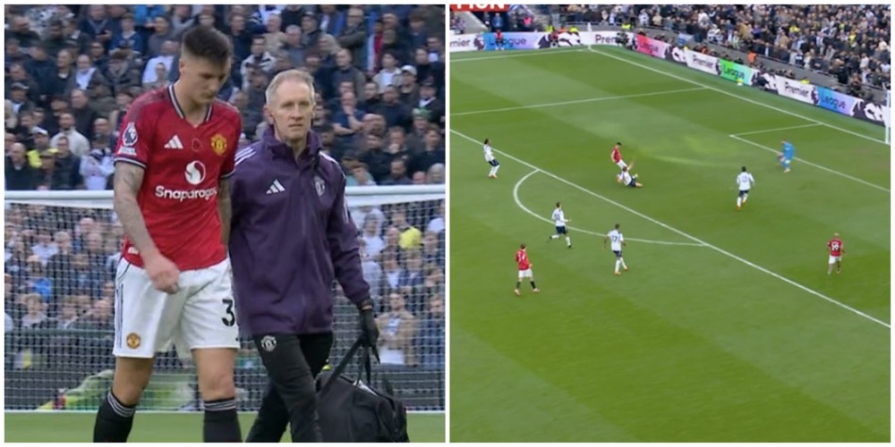📸🎥 Шешко должен был забивать, но травмировался. Оставил «МЮ» вдесятером и получил от клубной легенды