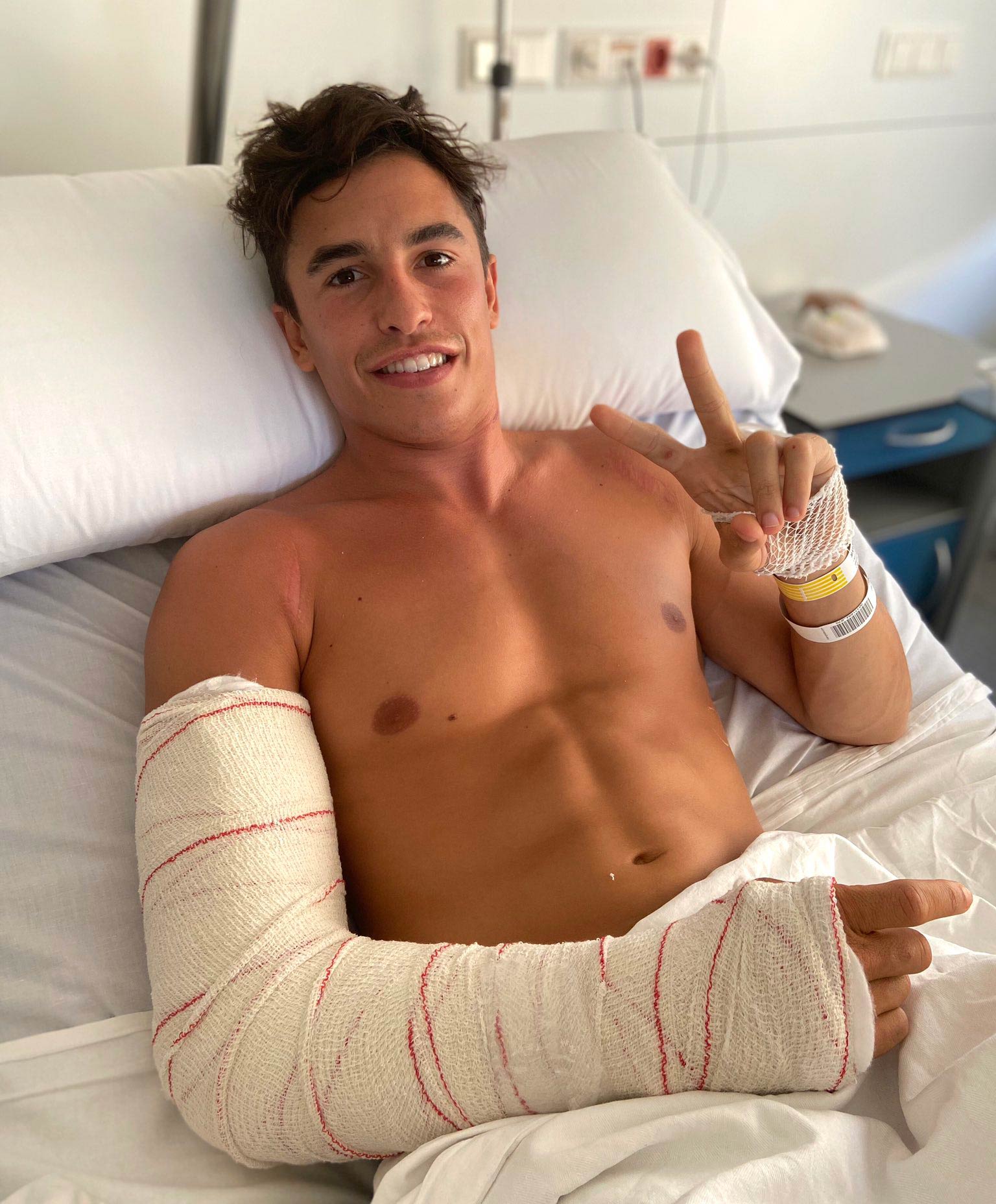 Marquez cleared of nerve damage after surgery | MCNews
