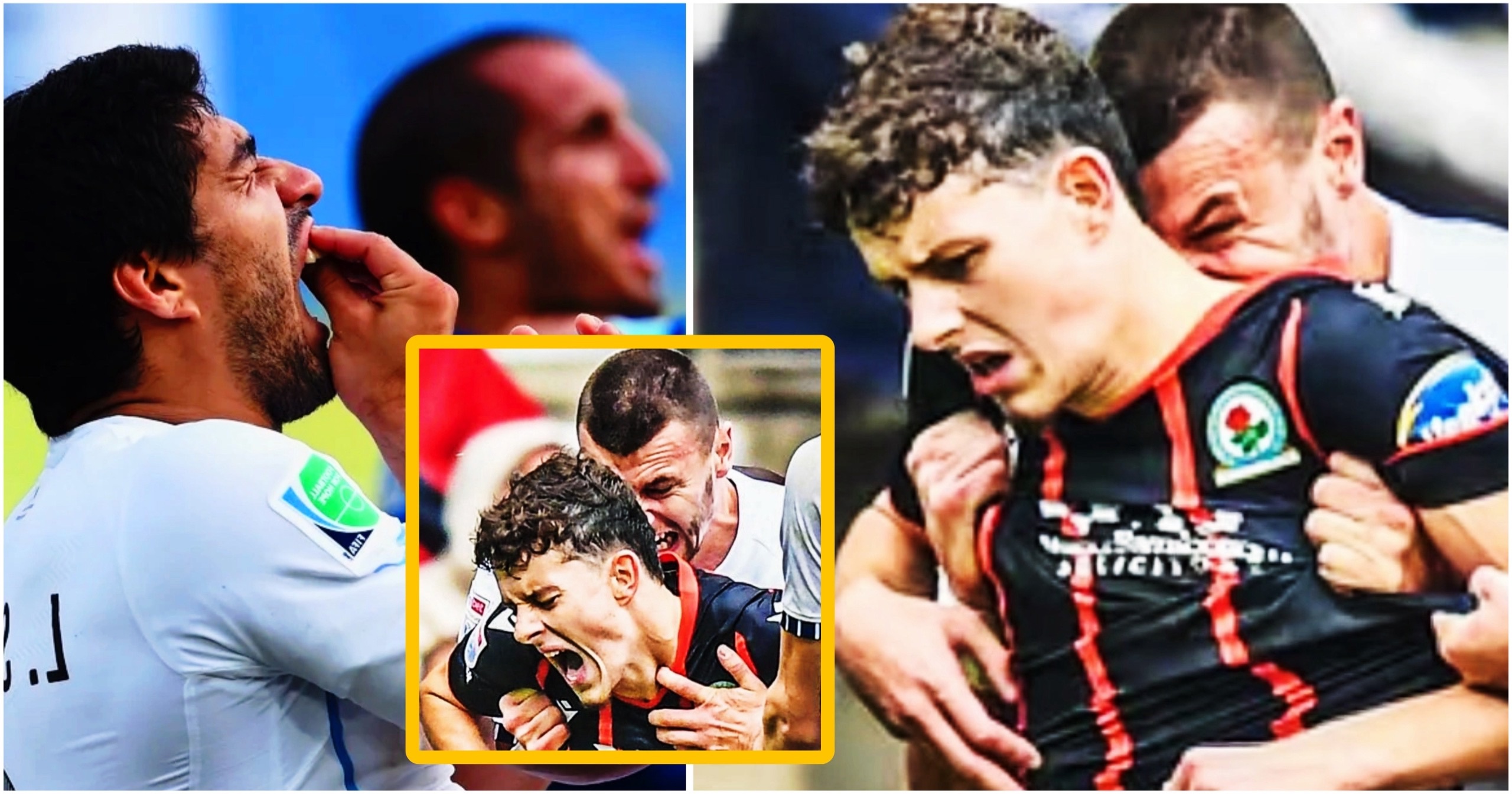 📸🎥 В Чемпионшипе нашелся новый Суарес! Игрок «Престона» получил бан и крупный штраф за укус соперника