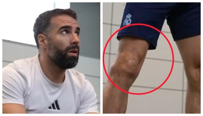 Даниэль Карвахаль, Реал Мадрид, Клубы