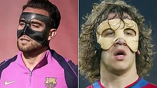 «Разные эпохи — один боевой дух»: «Барса» роскошно поддержала Гарсию после перелома носа